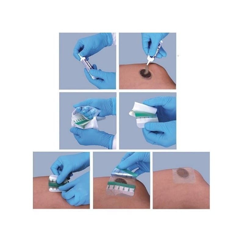 Medisorb G opatrunek hydrożelowy na rany martwicze 15 g 5 tubek w op.