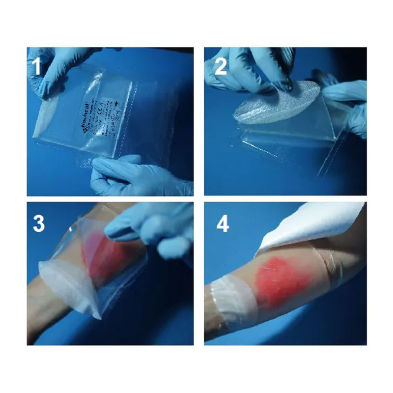 Sterylny opatrunek hydrożelowy Aqua-gel zestaw pierwsza pomoc na rany i oparzenia 1op