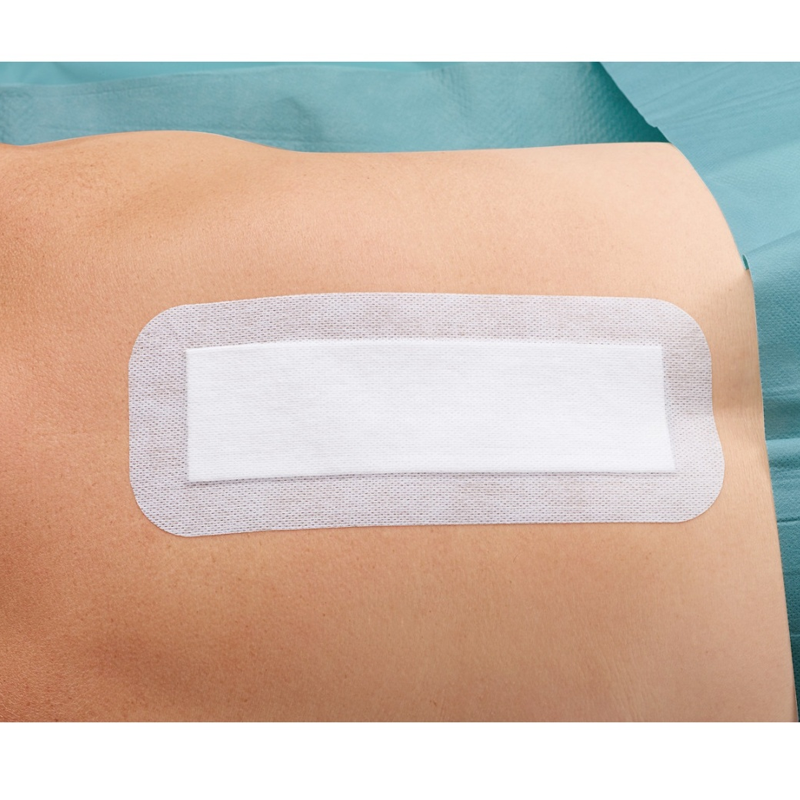 Plaster opatrunkowy Cosmopor E steril 25cm x 10 cm jałowy opatrunek pooperacyjny 25szt