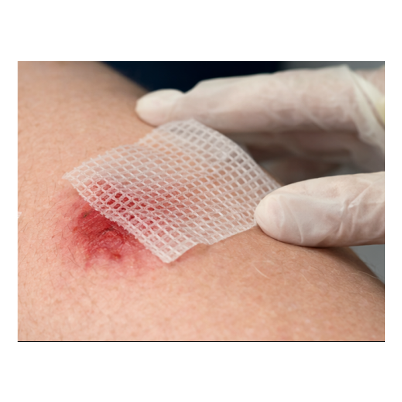 Bactigras 15x20 opatrunek parafinowy z chlorhexydyną Smith&Nephew 10szt