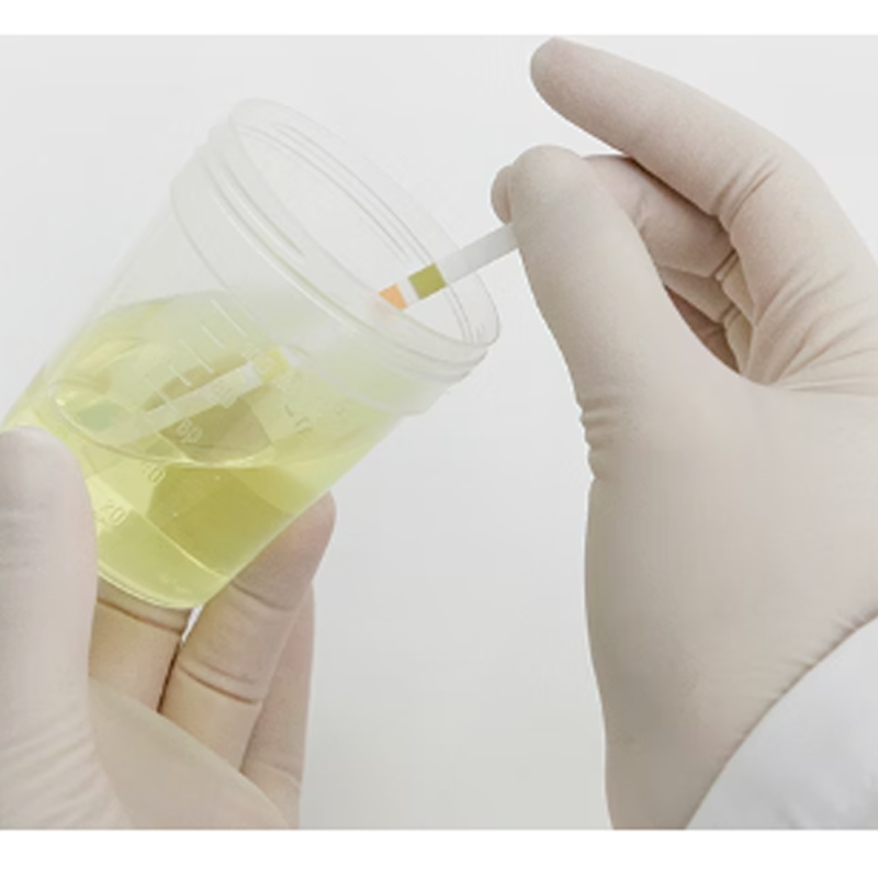 Paski do badania moczu Combur 10 parametr&oacute;w 100szt