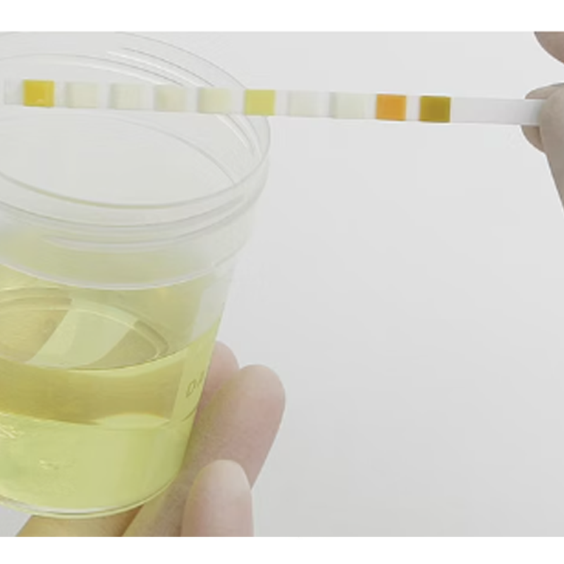 Paski do badania moczu Combur 10 parametr&oacute;w 100szt